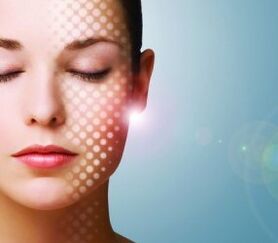 Laser rejuvenation