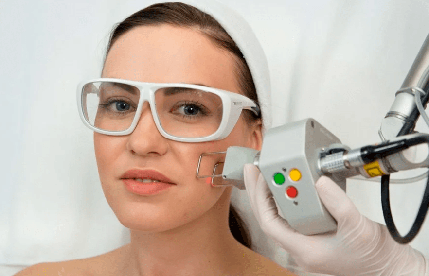 Laser rejuvenation