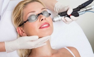how is the procedure for laser facial skin rejuvenation performed 